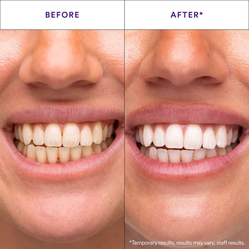 V34 Whitening Strips